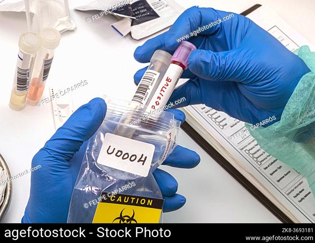 Nurse analyses positive PCR tests of covid-19 in a hospital laboratory, conceptual image