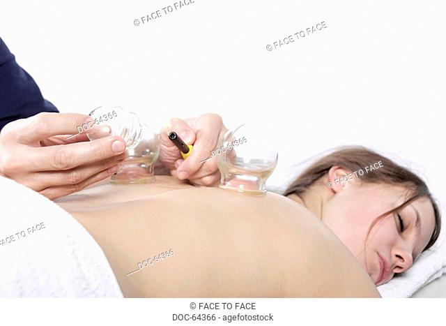 Young woman lying on bed receiving cupping acupuncture