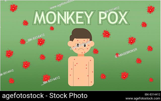 Monkeypox concept, Illustration of monkeypox skin urticaria, Vector of a person with monkeypox on their body. Illustration of the monkeypox virus