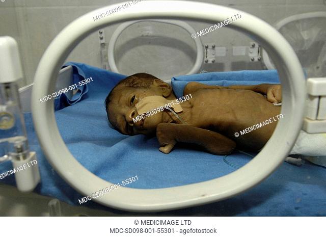 Premature baby in an incubator in the neonatal unit of a hospital. Premature babies are placed in incubator as they have not fully developed the mechanisms for...