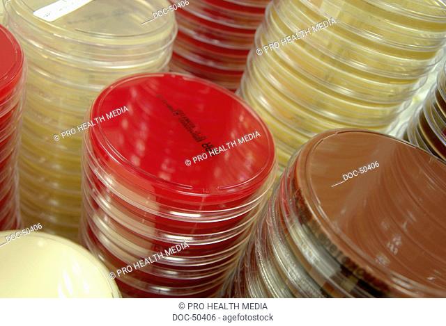 Stacks of culture media fŸr bacterial breeding
