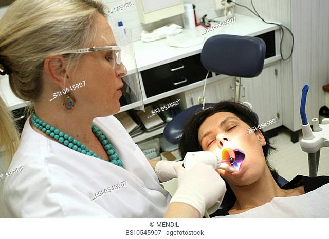 WOMAN RECEIVING DENTAL CARE Photo essay from dental office. Use of a curing light to harden the composite