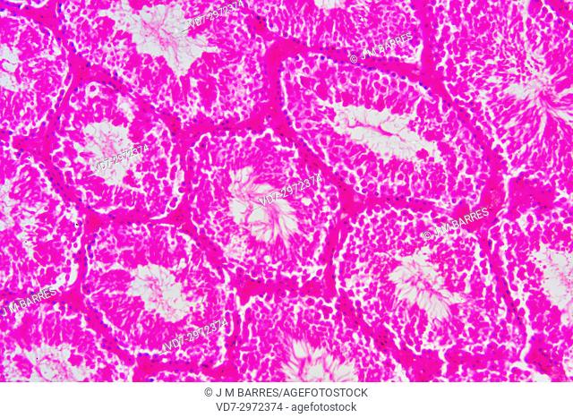 Human testicle or testis section showing seminiferous tubules, Leydig cells, Sertoli cells, spermatocytes and spermatogonia. Optical microscope X100