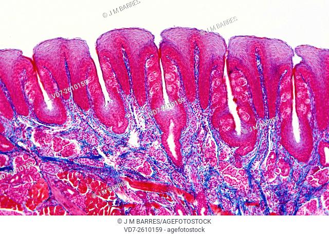 Gustatory papillae on the human tongue showing taste buds located in the epithelium. Light micrograph X40. Cross section