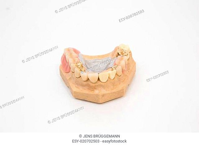 Sophisticated dental prosthesis