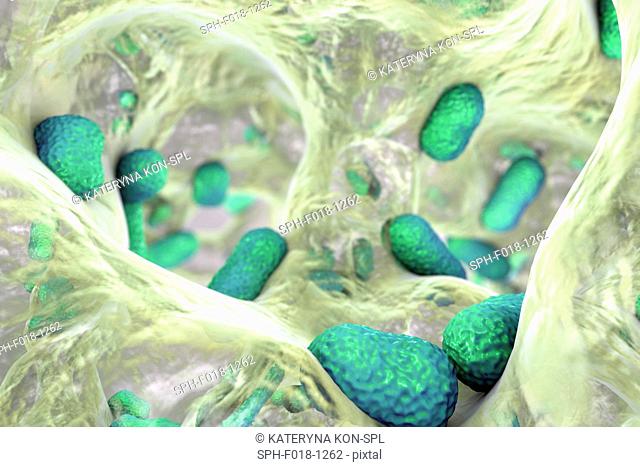 Multi-drug resistant Acinetobacter baumannii bacteria inside biofilm, computer illustration. A. baumannii is a Gram-negative, oxidase negative, aerobic