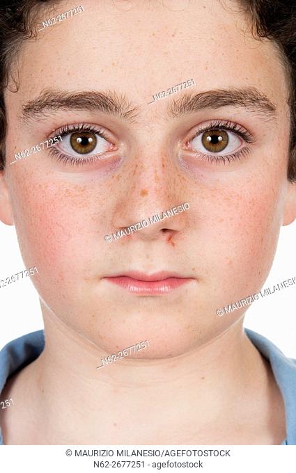 front view of a face of a boy with freckles