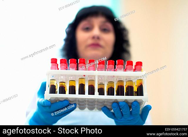 Belarus, Gomel, 24 April 2018. Blood transfusion station.Nurse with blood tests.Blood in test tubes