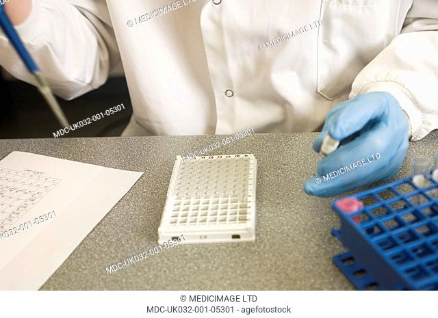 A scientist takes a sample from a series of vials containing saliva, to be placed into a test plate, ready for adrenal stress profile tests to be carried out
