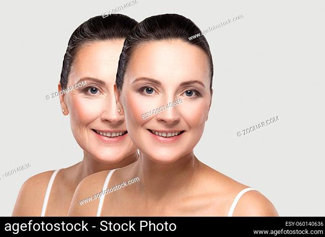 Before and after beauty skin wrinkles treatment procedure. Middle aged brunette woman looking, toothy smile. plastic surgery, cosmetic and purity concept