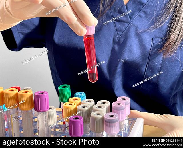 The serological test is done with a blood test to look for the presence of antibodies against the virus
