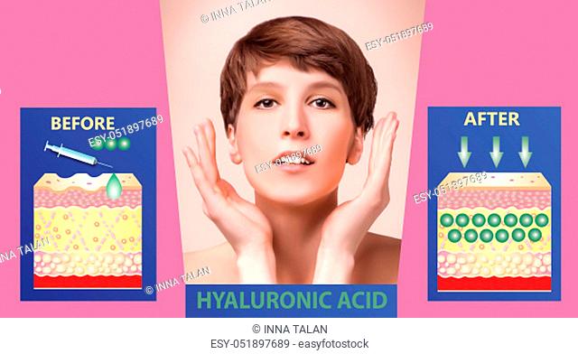 Hyaluronic acid. Skin-care products. The rejuvenation with help of treatment. Cosmetic or dermal fillers. Young female with clean fresh skin