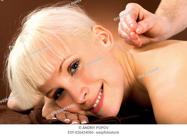 Close-up Of A Young Woman Receiving Acupuncture Treatment In A Beauty Spa