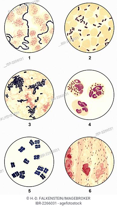 Bacteria smears of germs for microbiological diagnosis, microscope slides, clinical microbiology, state of scientific research around 1915, 1: Streptococci