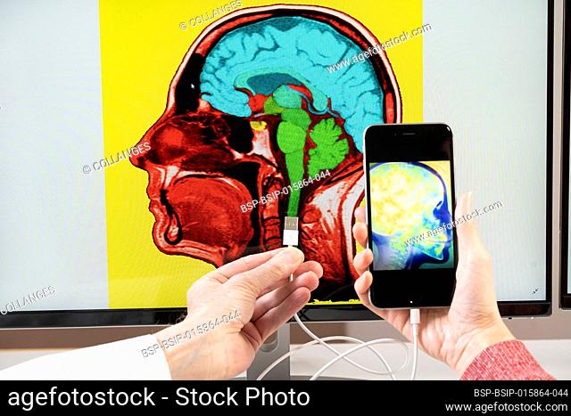 Close-up of hands holding a smartphone and connecting it to a brain image on a computer screen
