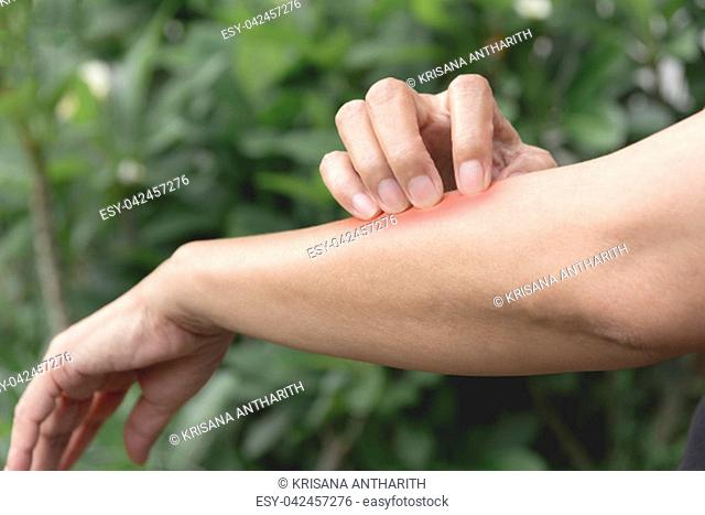 Women scratch itch with hand. Woman scratching her arm healthcare concept