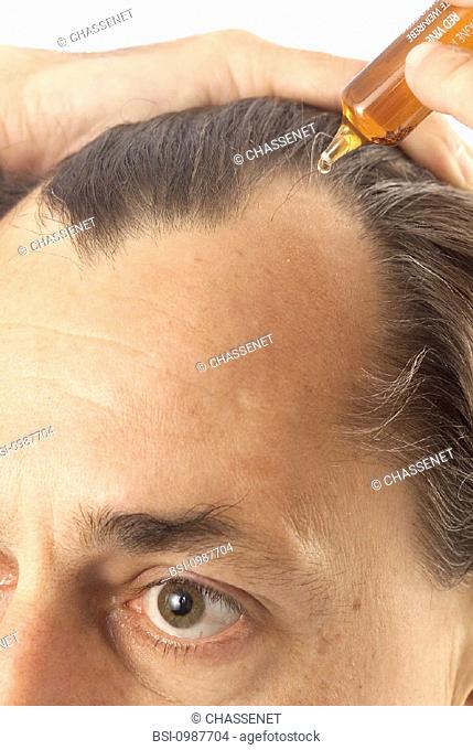 HAIR CARE<BR>Model.<BR>Treatment against hair-loss