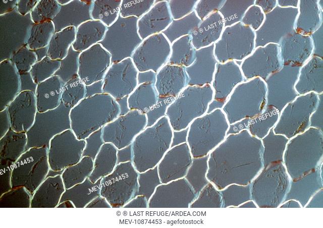 Light Micrograph (LM): transvers section shows Parenchyma Ground Tissue in Buttercup stem. Magnification x600 (on 10.5 cm width print)