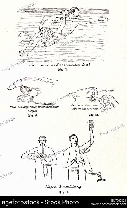 First aid in cases of misfortune, Praktischer Hausschatz der Heilkunde, II. volume, 1930, Heinrich Killinger, Nordhausen
