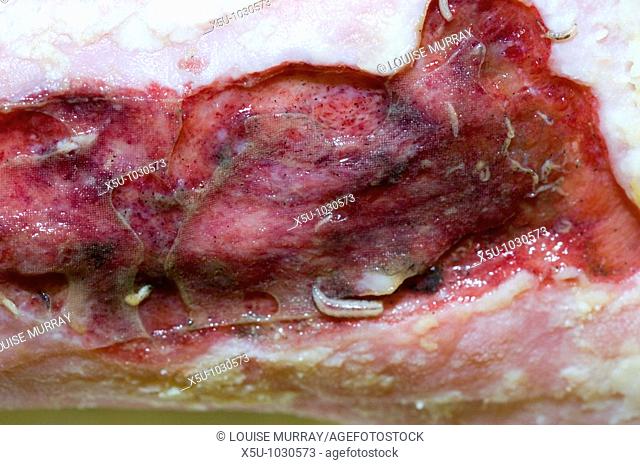 Treatment of a leg ulcer with maggot therapy  Patient Olive Dunseath 79 years old had wound for 10 years  THe wound after three days of maggot therapy  The...