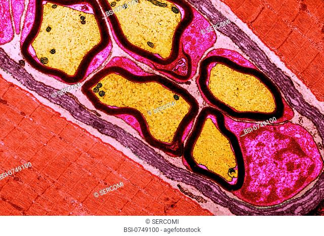 This histology section of a striated muscle red shows the nerve fibers coated with their myelin sheath yellow structures with a dark outline