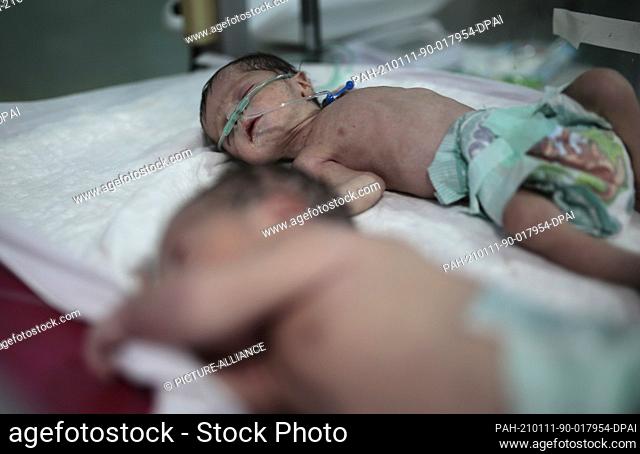 11 January 2021, Yemen, Sanaa: Two malnourished newborn babies lie on a hospital bed as they receive treatment at the UniMax International Hospital