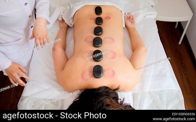 Stones on the back of a girl in a physiotherapy room, close-up
