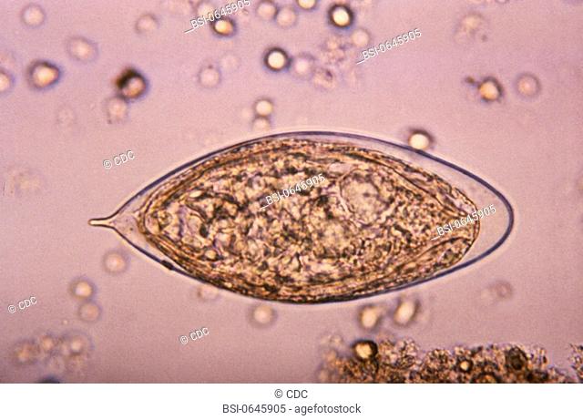 SCHISTOSOMA HAEMATOBIUM<BR>Schistosoma haematobium eggs.  In this species, the eggs are large and have a prominent terminal spine at the posterior end