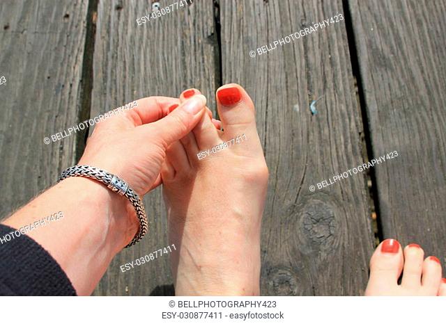 A lady checking between her toes symbolizing athletes foot and the importance of drying between the toes for healthy feet