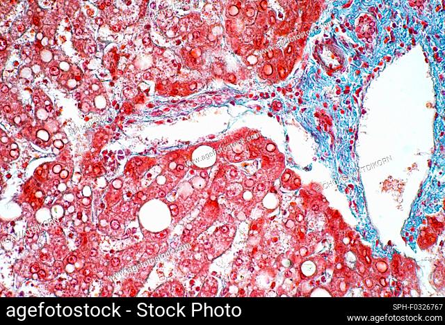 Liver tissue, light micrograph