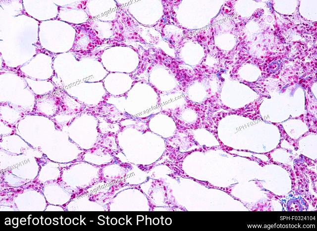 Human lung tissue, light micrograph