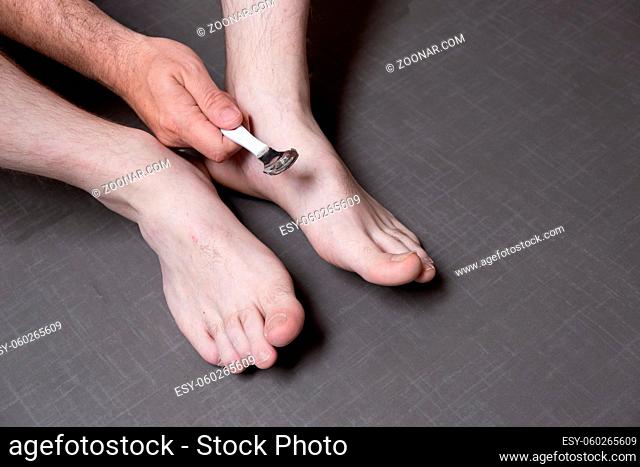 Man removing corn, callus from his feet using a razor file, masculine skin care, skin disease, fungal infection, skin treatment and healthcare, close up