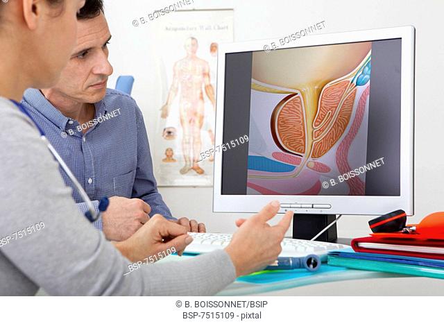 UROLOGY CONSULTATION MAN Models. On screen, drawing illustrating the prostate (without pathology)