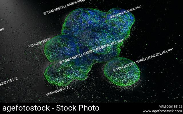 Camera zooms into 3D model of microscopic image showing a culture of human breast cancer cells in a dish. DNA is stained blue and a protein in the cell surface...