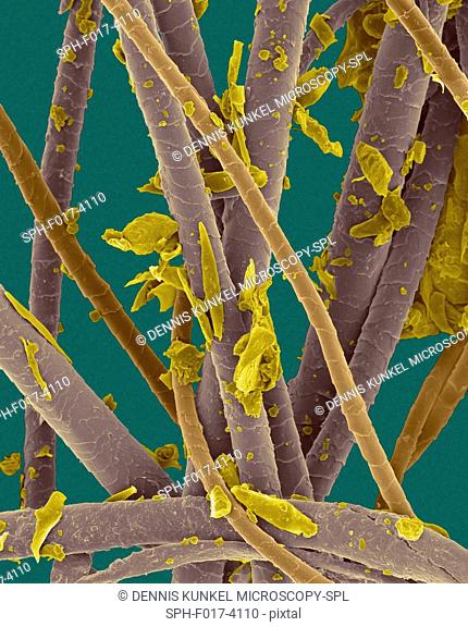 Coloured scanning electron micrograph (SEM) Pet dander. dog hair, cat hair and dead skin (cat hair. brown, dog hair. purple, dander. yellow)