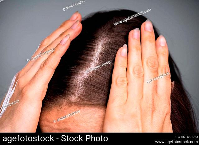 Close-up Of Woman With Thinning Hair On Head