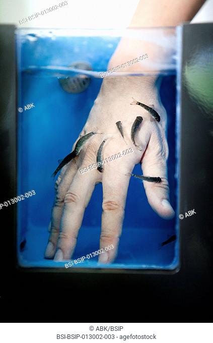 The fish therapy is originated from Turkey, in the Kandal district, living place of the Garra Rufa or doctor fish. These fish eat the dead cells of the skin