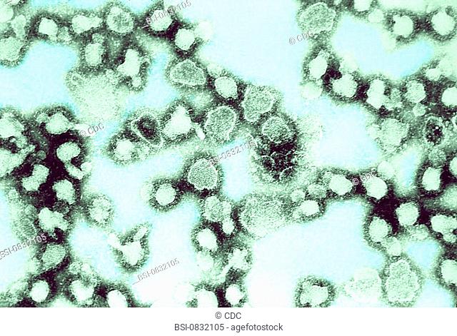 LA CROSSE VIRUS<BR>This electron micrograph reveals the morphologic traits of the La Crosse virus (LACV), a Bunyaviridae virus family member