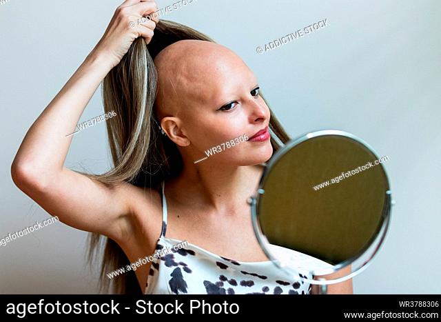 baldness, wig, hair loss