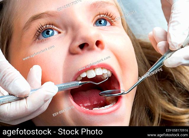 Macro close up portrait of Little girl with open mouth having dental check up