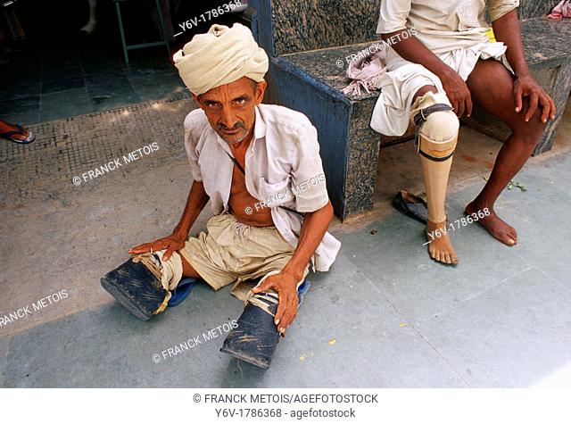 Amputated men. One has a prosthetic leg while another is waiting for two. Jaipur, India
