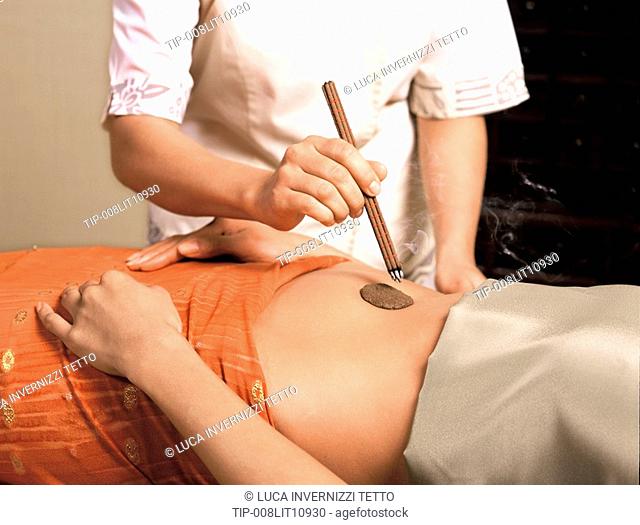 Woman receiving moxa treatment on abdomen