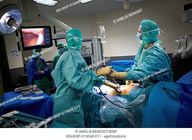 Reportage in an operating theatre during a hysterectomy using the da Vinci robot®. The surgeon chooses entry points for the 4 arms of the robot