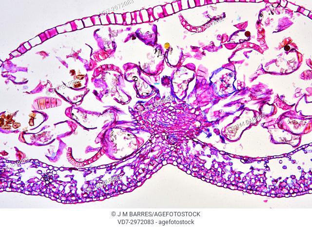 Sorus with sporangia of fern Aspidium sp. Optical microscope X100