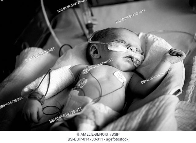 Reportage in the level 2, neonatology service in a hospital in Haute-Savoie, France. A newborn baby in respiratory distress having inhaled some amniotic fluid
