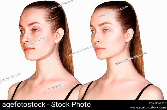 Beautiful young woman with arrows on face. Cosmitic procedures concept