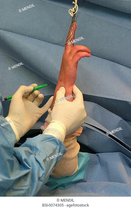 ORTHOPEDIC SURGERY<BR>Photo essay from clinic.<BR>Reims, France