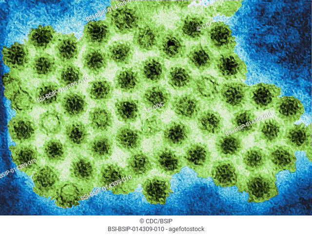 This transmission electron micrograph (TEM) revealed some of the ultrastructural morphology displayed by norovirus virions, or virus particles
