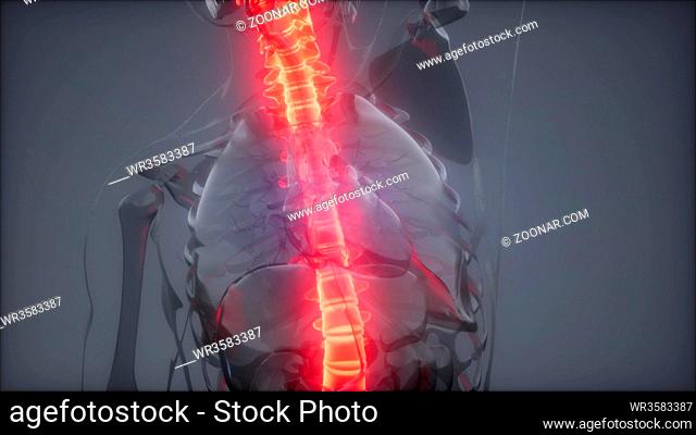 Hurt Spine. Male Backbone. Backache, Headache - Vertebrae Pain