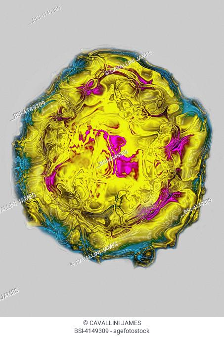 Hepatitis B virus HBV. Image HDRI made according to a view under transmission electron microscope. Viral diameter 42 nm. 10 of people infected with the...